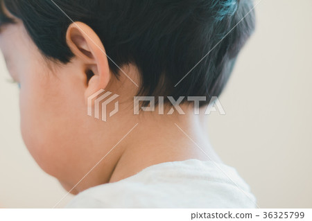 nape of the neck, younger, 2 years old 36325799