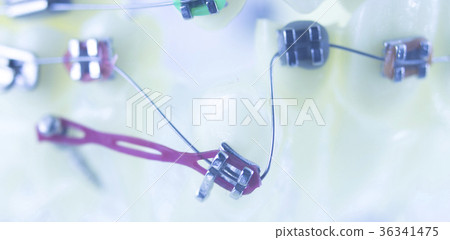 Dental teeth brackets aligners 36341475