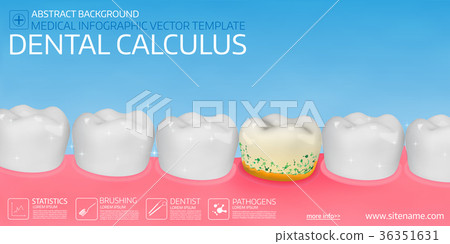 Dental calculus horisontal medical banner  36351631