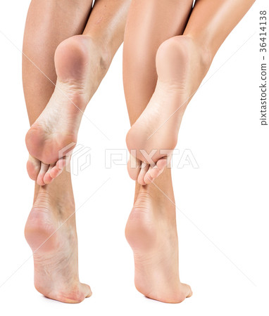 Feet with dry skin before and after treatment. 36414138