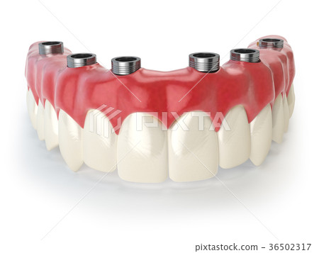 Dental prothesis isolated on white Dental prothesis isolated on white 36502317
