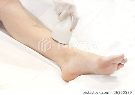 The process of laser depilation of female limbs in The process of laser depilation of female limbs in 36560589