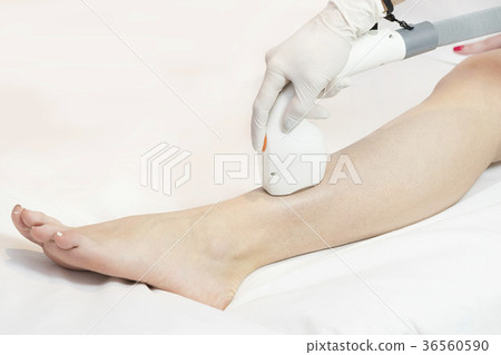 The process of laser depilation of female limbs in 36560590