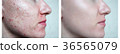skin face.daughter 36565079