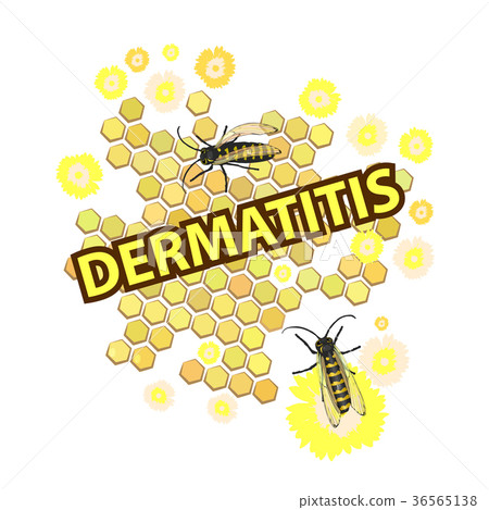 dermatitis. inscription with bees and 36565138