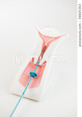 Birth control symbol iud on white background Birth control symbol iud on white background 36605363