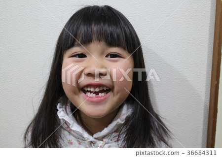 Girl with missing front teeth 36684311