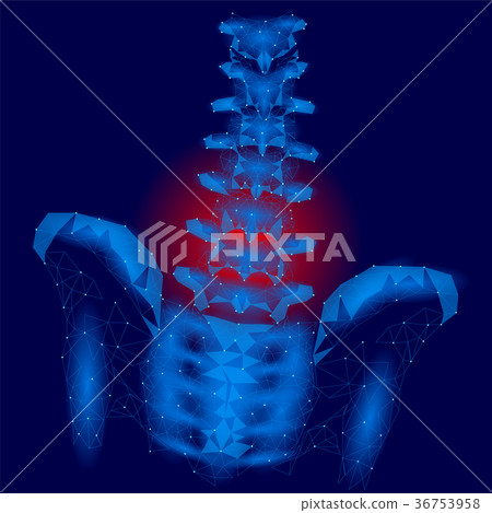 Human spine hip lumbar radiculitis pain low poly 36753958