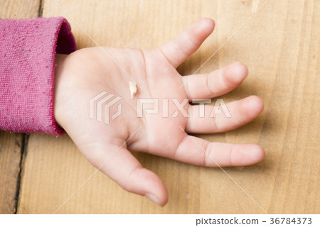 Child's hand with missing milk teeth 36784373