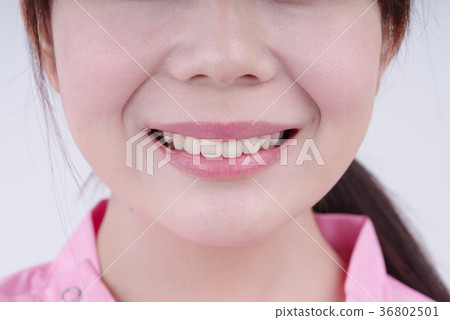 Close up of teeth 36802501