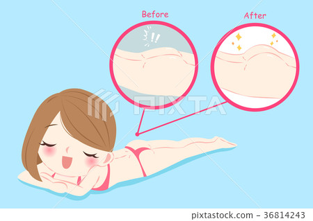 woman with butt implant 36814243