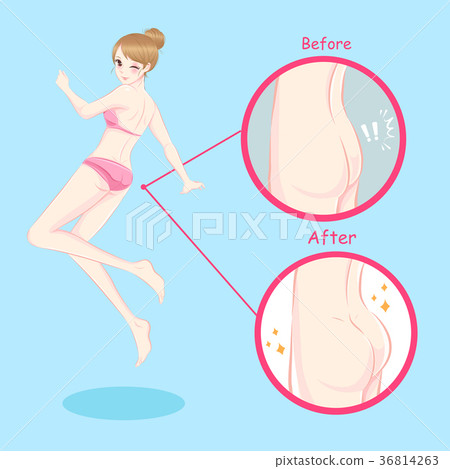 woman with butt implant woman with butt implant 36814263
