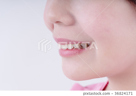Close up of teeth 36824171