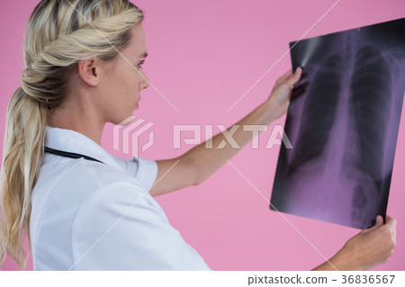 Side view of female doctor looking at X-ray Side view of female doctor looking at X-ray 36836567