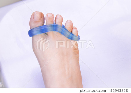 Foot of woman with silicone prosthesis Foot of woman with silicone prosthesis 36943838