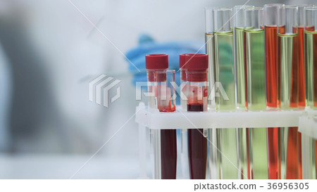 Blood samples standing on the table, HIV test 36956305