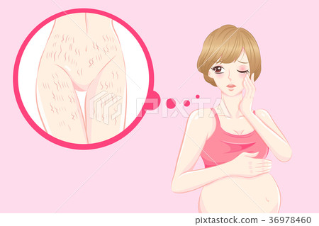 woman with stretch mark skin woman with stretch mark skin 36978460