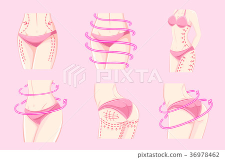 woman with body plastic surgery woman with body plastic surgery 36978462