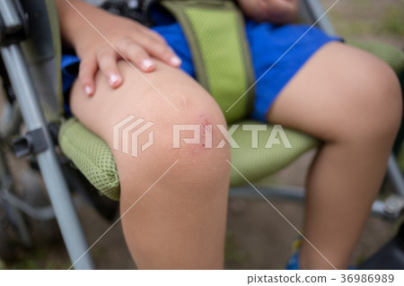 knee, knees, surimuku 36986989