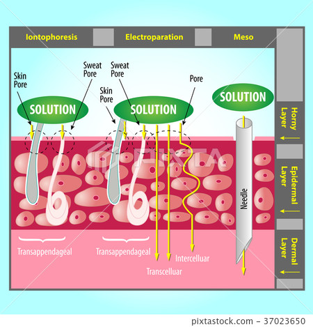 Transdermal Delivery Transdermal Delivery 37023650