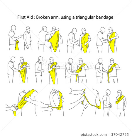 Broken arm using a triangular bandage vector  37042735