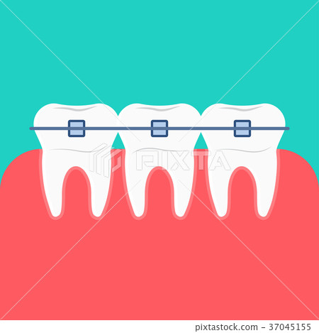 Teeth braces vector icon. - Stock Illustration [37045155] - PIXTA