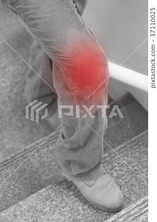 knee joint pain concept, leg stepping up on stairs 37110025