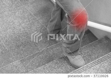 knee joint pain concept, leg stepping up on stairs 37110026