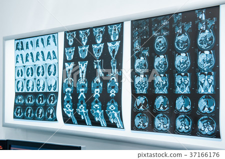 Several resonance imaging (MRI) of the brain.  37166176