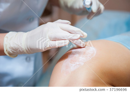 Application of anesthetic cream after laser Application of anesthetic cream after laser 37196696