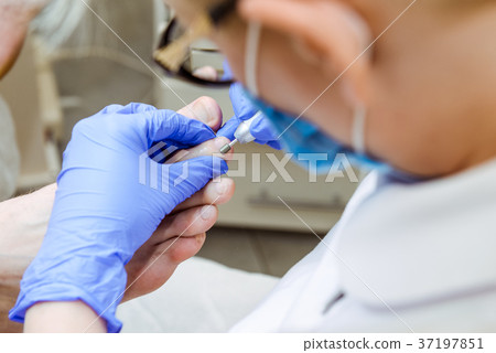 Master chiropody shapes the nails  37197851