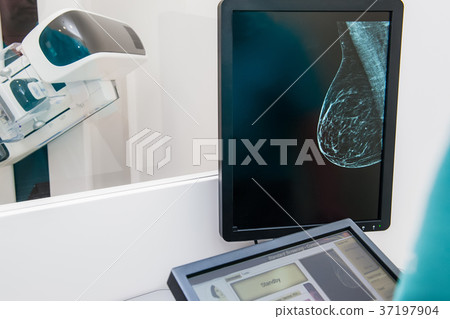 Mammogram snapshot of breasts of a female  37197904