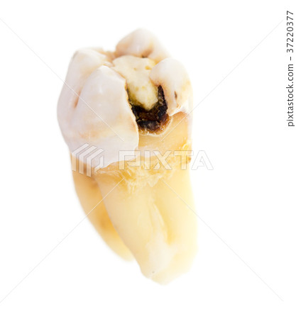 Old torn tooth on a white background 37220377