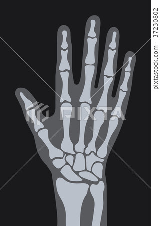 vector x-ray hand vector x-ray hand 37230802