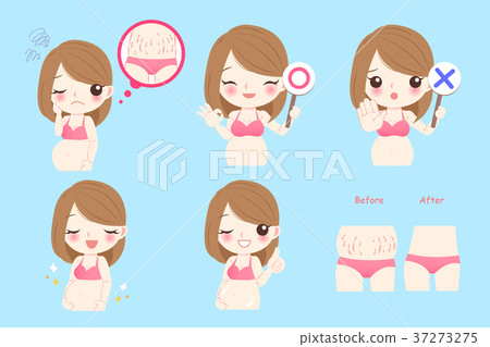 pregnant woman with stretch marks pregnant woman with stretch marks 37273275