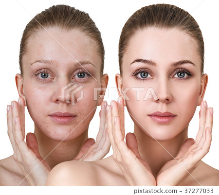 Young woman without and with makeup Young woman without and with makeup 37277033