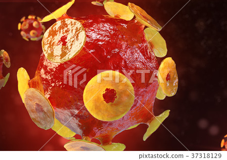 Viral hepatitis infection causing chronic liver 37318129