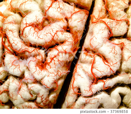 Human brain closeup Human brain closeup 37369858