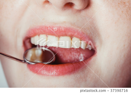 Check the teeth 37398716