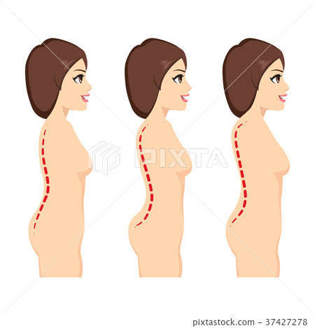 Scoliosis Medical Condition Scoliosis Medical Condition 37427278