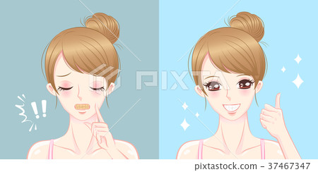 woman with tooth whiten cocncept woman with tooth whiten cocncept 37467347