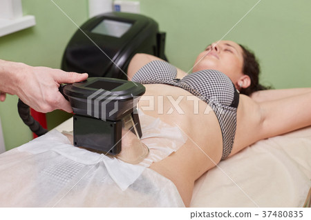 Woman getting cryolipolysis fat treatment 37480835