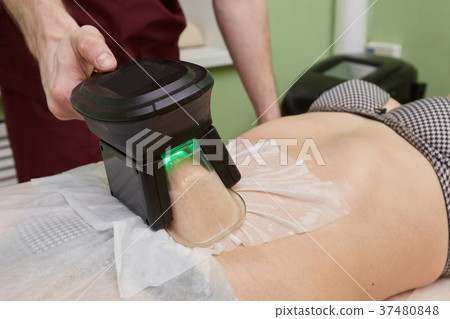 Woman getting cryolipolysis fat treatment 37480848