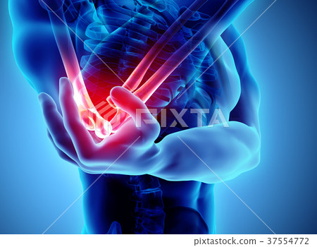 3d illustration of human elbow injury. 37554772