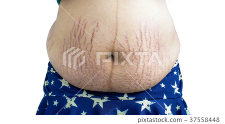 Pregnant woman with cracks 37558448