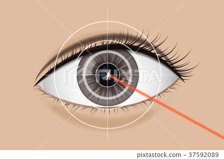 Of laser vision correction. 37592089