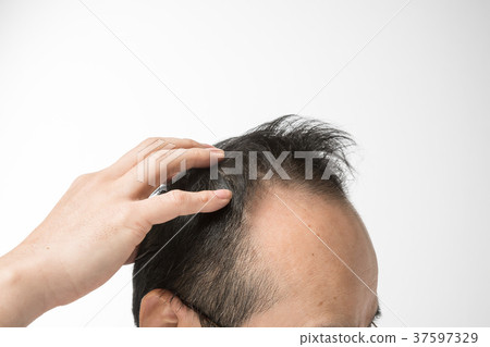 中年男士稀發 37597329