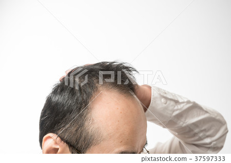 Middle men thin hair 37597333