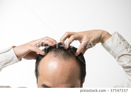 Middle men thin hair 37597337