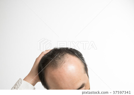 中年男士稀發 中年男士稀發 37597341